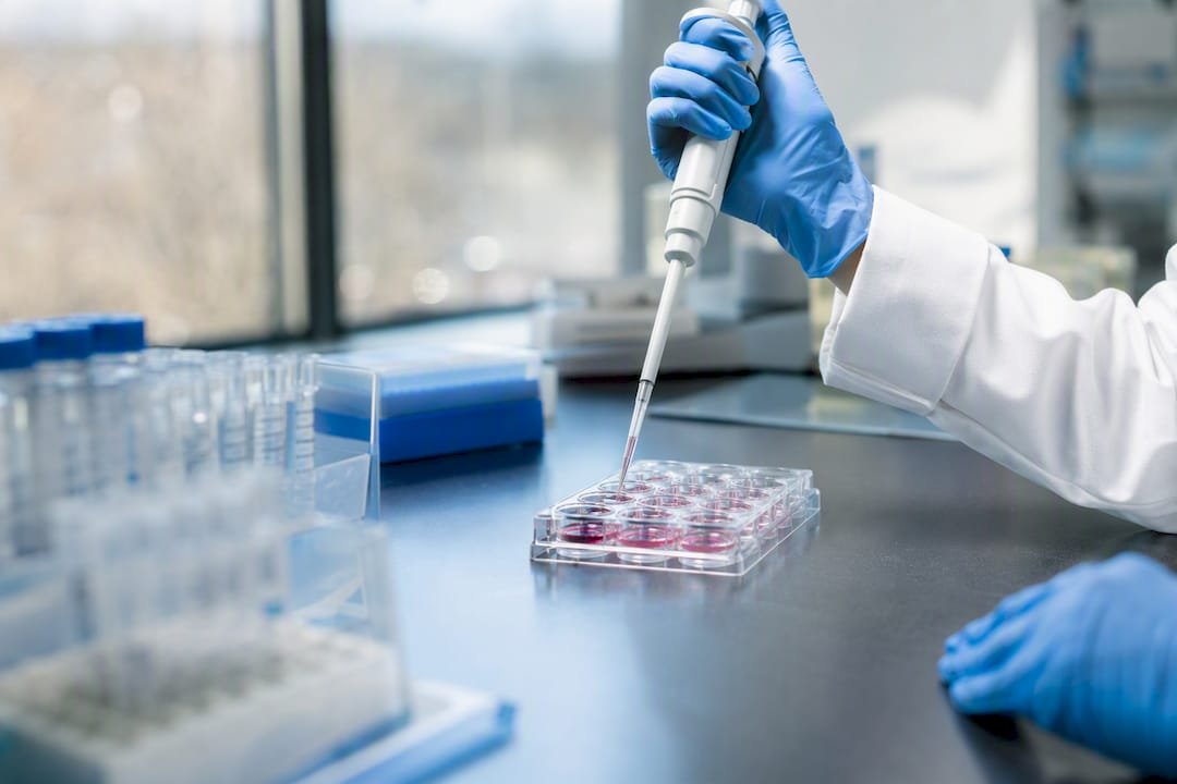 How to Calculate MOI for Viral Transduction Experiments
